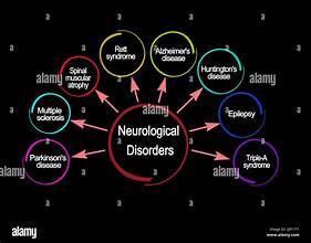 doctorhub360.com neurological diseases 